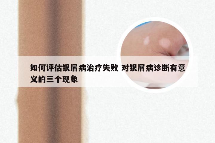 如何评估银屑病治疗失败 对银屑病诊断有意义的三个现象