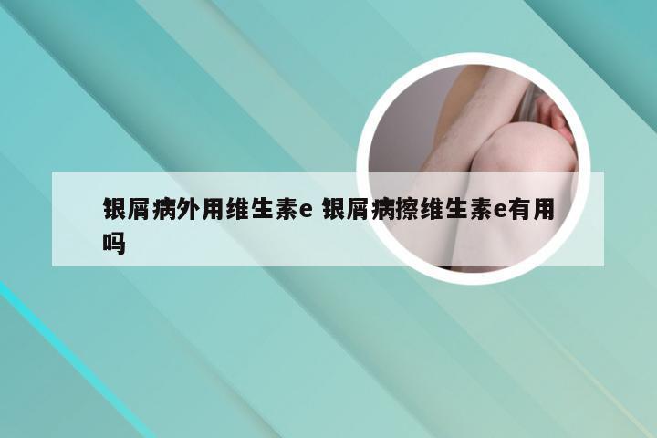 银屑病外用维生素e 银屑病擦维生素e有用吗