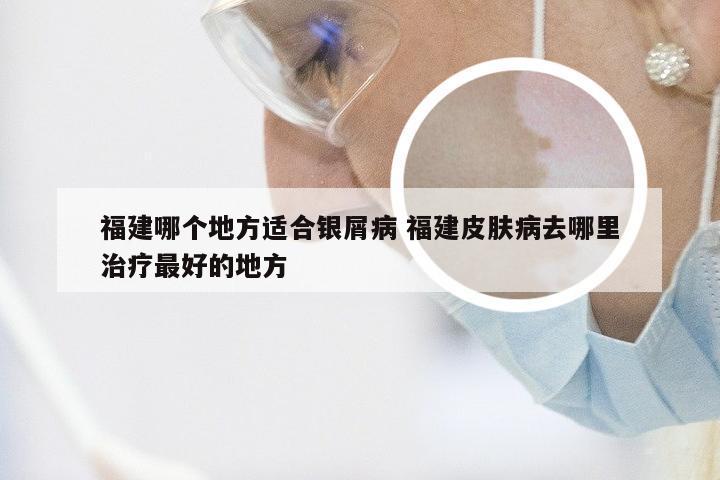 福建哪个地方适合银屑病 福建皮肤病去哪里治疗最好的地方