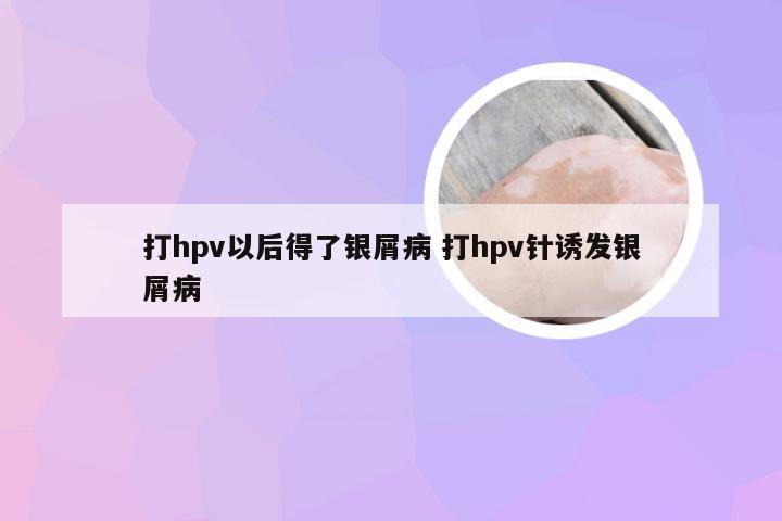 打hpv以后得了银屑病 打hpv针诱发银屑病