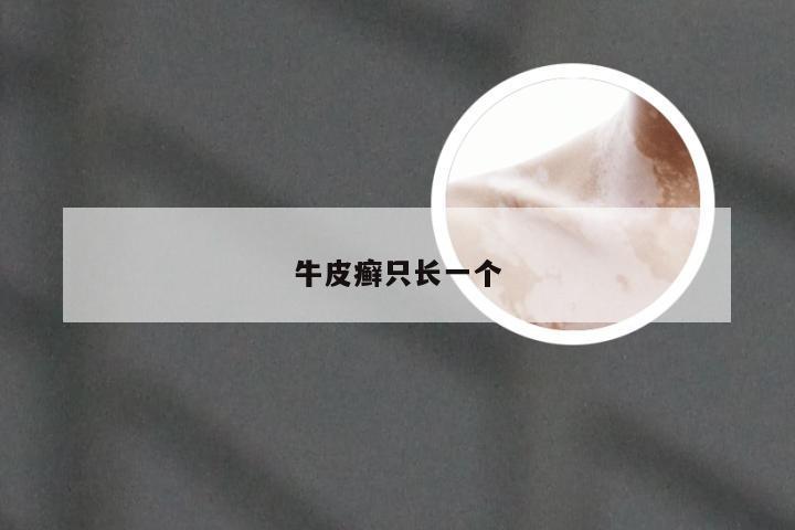 牛皮癣只长一个