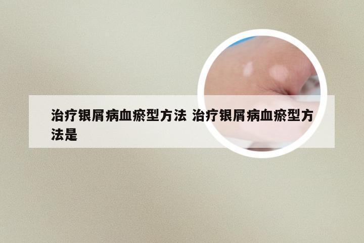 治疗银屑病血瘀型方法 治疗银屑病血瘀型方法是