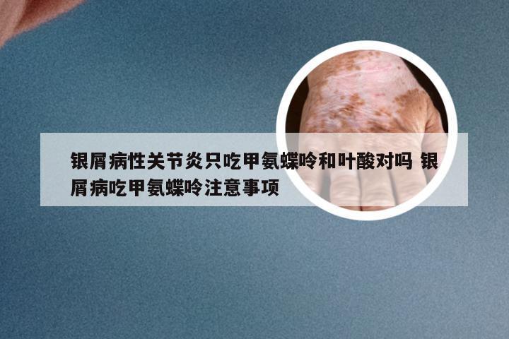 银屑病性关节炎只吃甲氨蝶呤和叶酸对吗 银屑病吃甲氨蝶呤注意事项