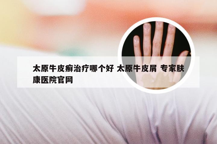 太原牛皮癣治疗哪个好 太原牛皮屑 专家肤康医院官网