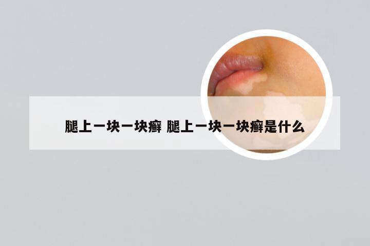 腿上一块一块癣 腿上一块一块癣是什么