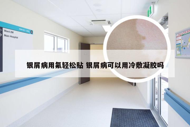 银屑病用氟轻松贴 银屑病可以用冷敷凝胶吗