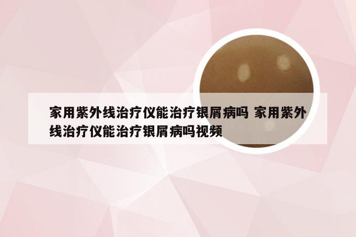 家用紫外线治疗仪能治疗银屑病吗 家用紫外线治疗仪能治疗银屑病吗视频