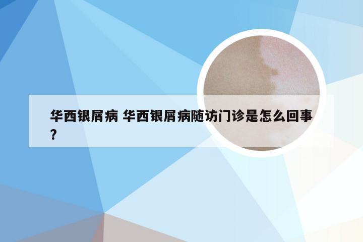 华西银屑病 华西银屑病随访门诊是怎么回事?