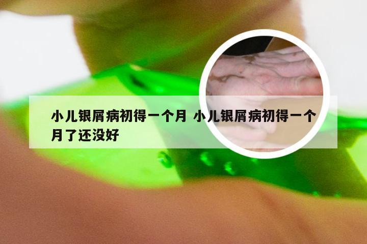 小儿银屑病初得一个月 小儿银屑病初得一个月了还没好