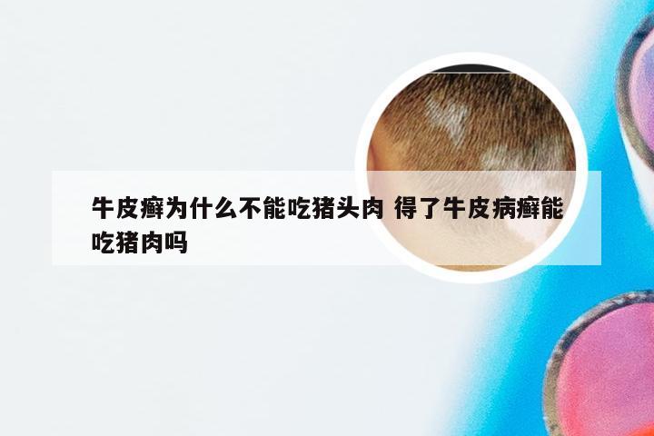 牛皮癣为什么不能吃猪头肉 得了牛皮病癣能吃猪肉吗