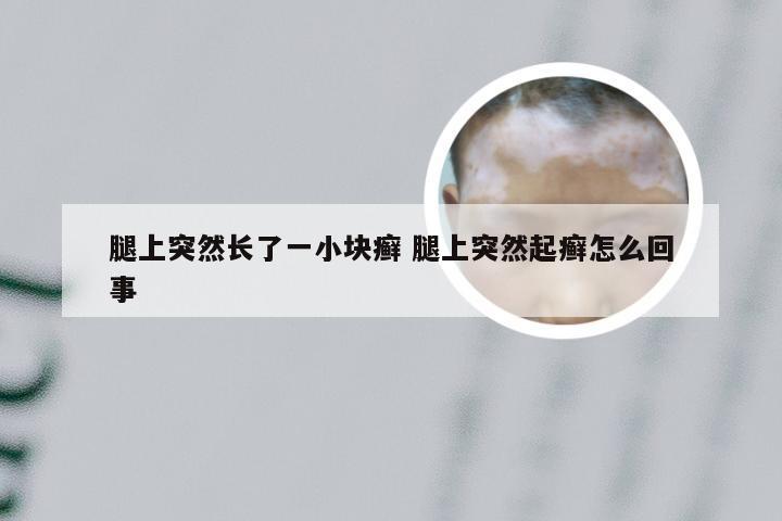 腿上突然长了一小块癣 腿上突然起癣怎么回事