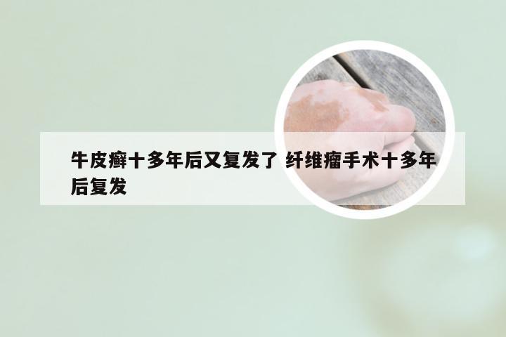 牛皮癣十多年后又复发了 纤维瘤手术十多年后复发