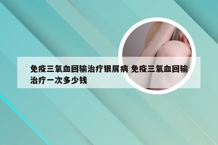 免疫三氧血回输治疗银屑病 免疫三氧血回输治疗一次多少钱