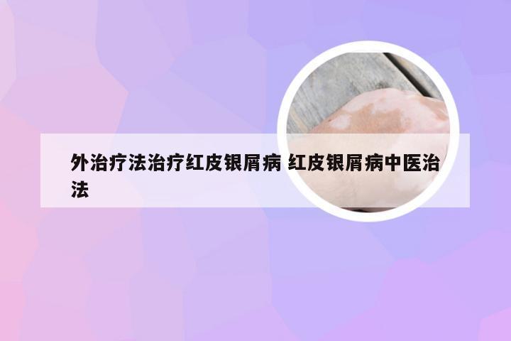 外治疗法治疗红皮银屑病 红皮银屑病中医治法