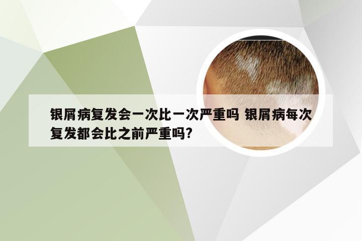 银屑病复发会一次比一次严重吗 银屑病每次复发都会比之前严重吗?