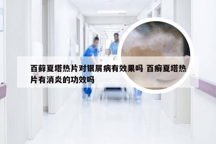 百藓夏塔热片对银屑病有效果吗 百癣夏塔热片有消炎的功效吗