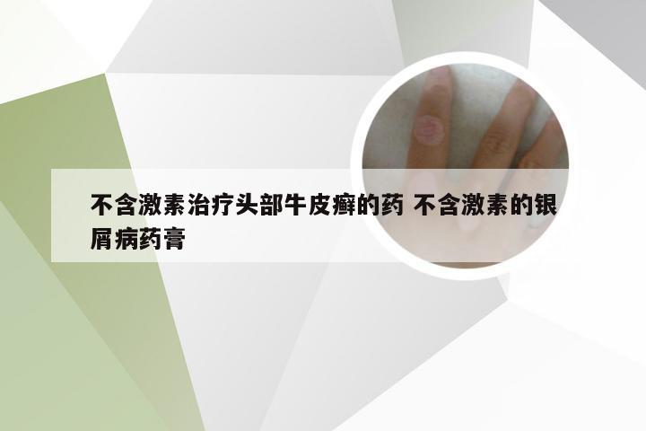 不含激素治疗头部牛皮癣的药 不含激素的银屑病药膏