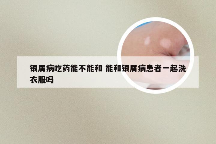 银屑病吃药能不能和 能和银屑病患者一起洗衣服吗