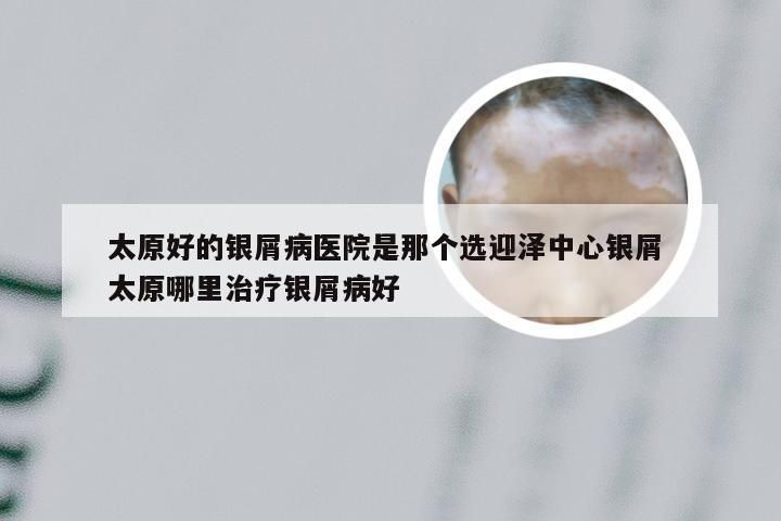 太原好的银屑病医院是那个选迎泽中心银屑 太原哪里治疗银屑病好
