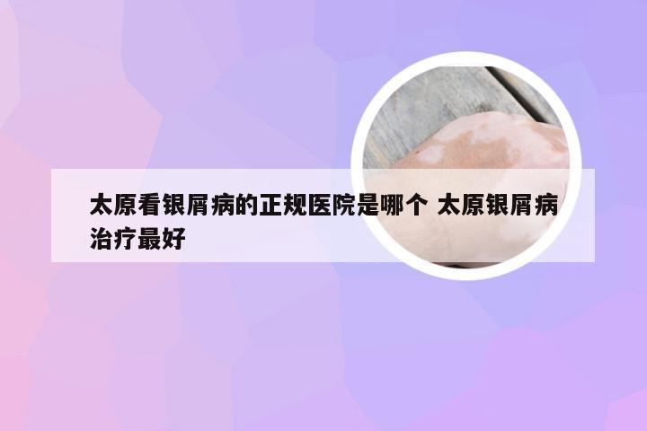 太原看银屑病的正规医院是哪个 太原银屑病治疗最好