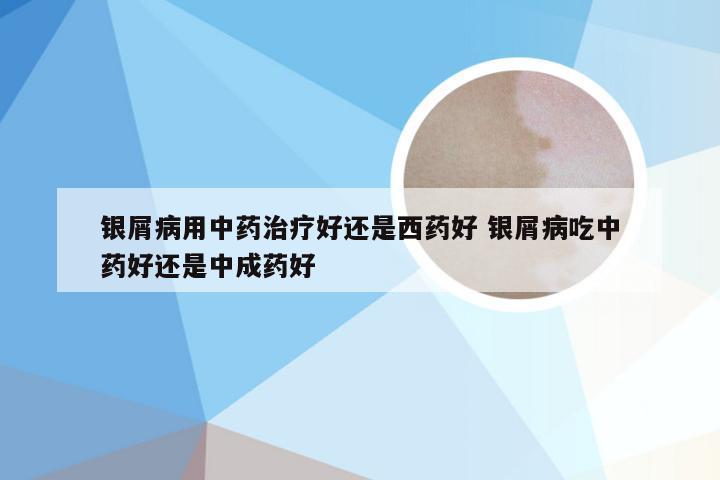 银屑病用中药治疗好还是西药好 银屑病吃中药好还是中成药好