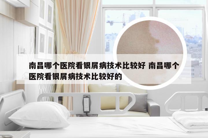 南昌哪个医院看银屑病技术比较好 南昌哪个医院看银屑病技术比较好的