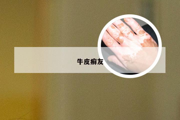牛皮癣友