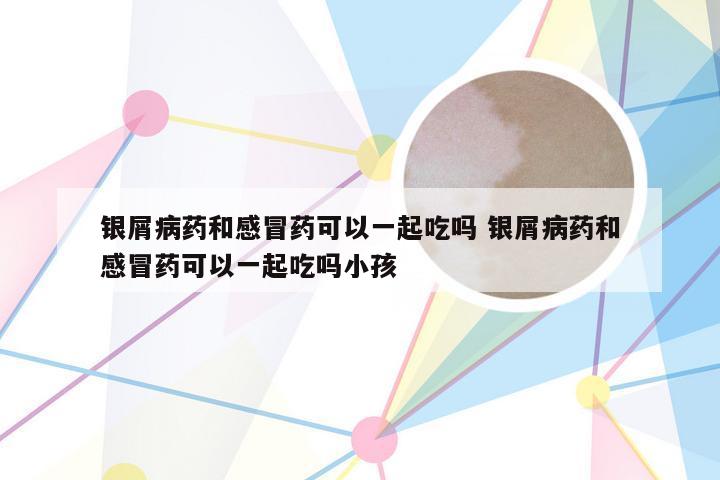 银屑病药和感冒药可以一起吃吗 银屑病药和感冒药可以一起吃吗小孩