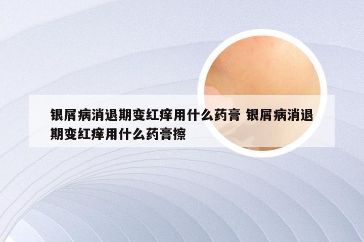银屑病消退期变红痒用什么药膏 银屑病消退期变红痒用什么药膏擦