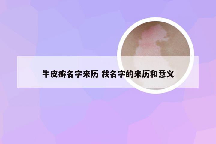 牛皮癣名字来历 我名字的来历和意义