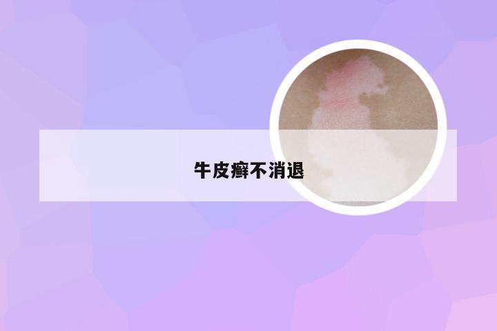 牛皮癣不消退