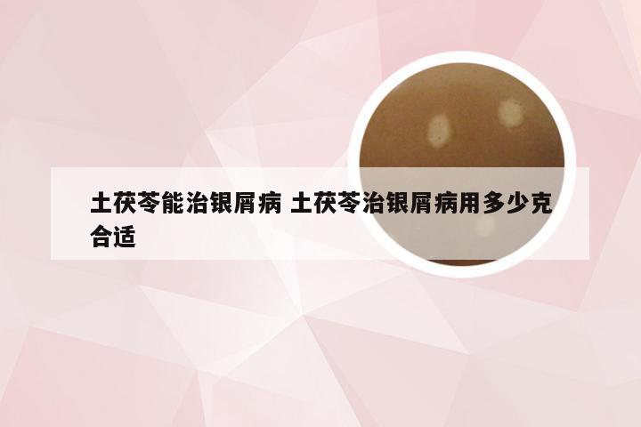 土茯苓能治银屑病 土茯苓治银屑病用多少克合适