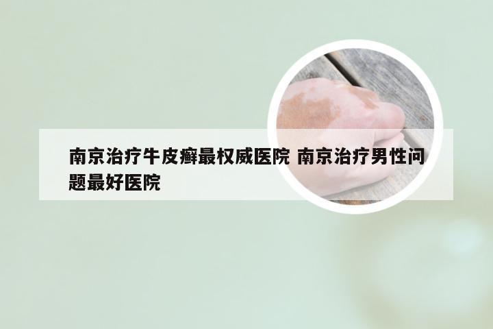 南京治疗牛皮癣最权威医院 南京治疗男性问题最好医院