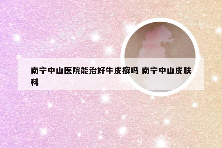 南宁中山医院能治好牛皮癣吗 南宁中山皮肤科