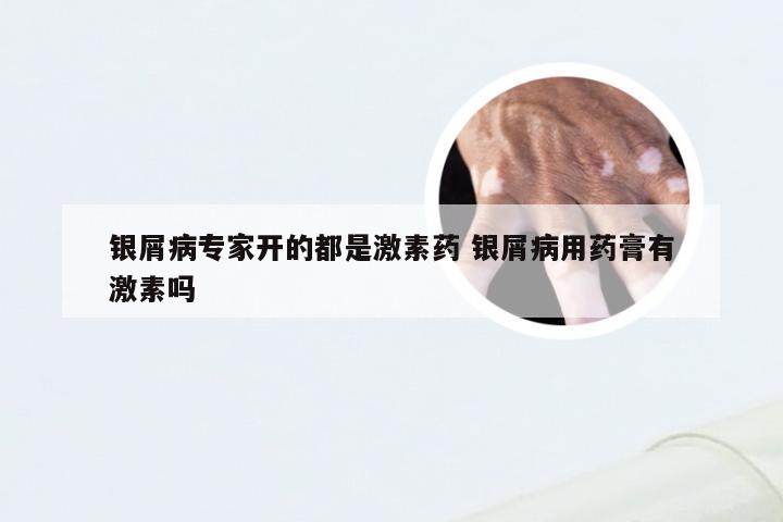 银屑病专家开的都是激素药 银屑病用药膏有激素吗