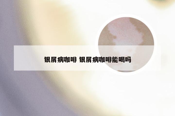 银屑病咖啡 银屑病咖啡能喝吗