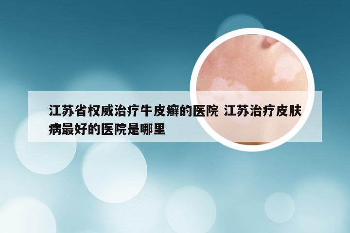 江苏省权威治疗牛皮癣的医院 江苏治疗皮肤病最好的医院是哪里