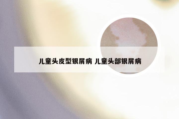 儿童头皮型银屑病 儿童头部银屑病
