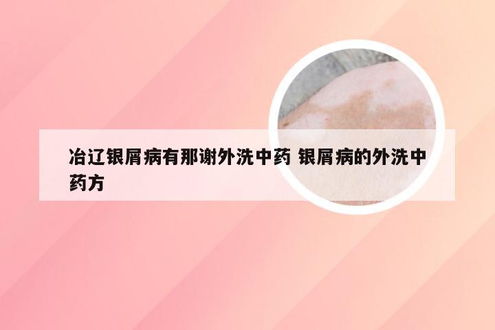 冶辽银屑病有那谢外洗中药 银屑病的外洗中药方