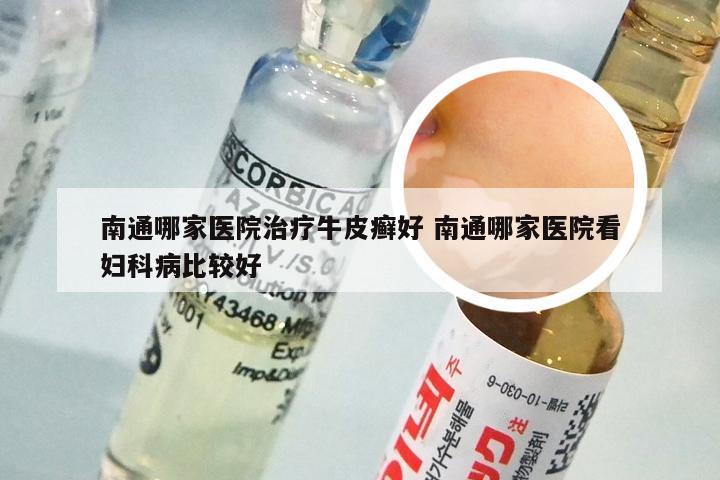 南通哪家医院治疗牛皮癣好 南通哪家医院看妇科病比较好