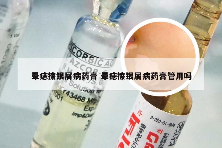 晕痣擦银屑病药膏 晕痣擦银屑病药膏管用吗