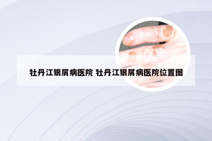 牡丹江银屑病医院 牡丹江银屑病医院位置图