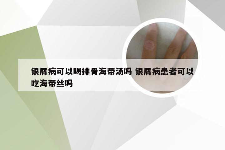 银屑病可以喝排骨海带汤吗 银屑病患者可以吃海带丝吗