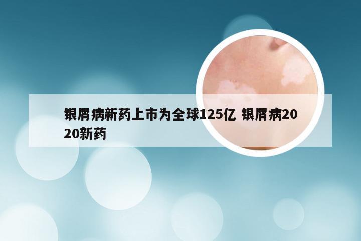 银屑病新药上市为全球125亿 银屑病2020新药