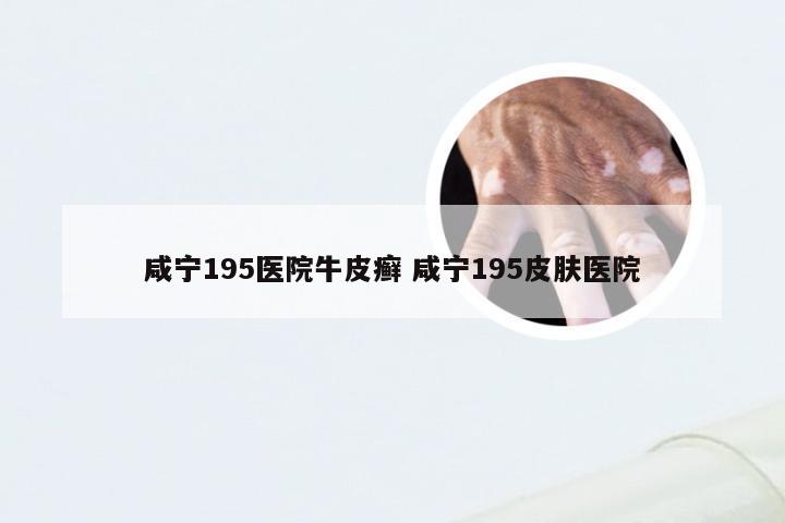 咸宁195医院牛皮癣 咸宁195皮肤医院