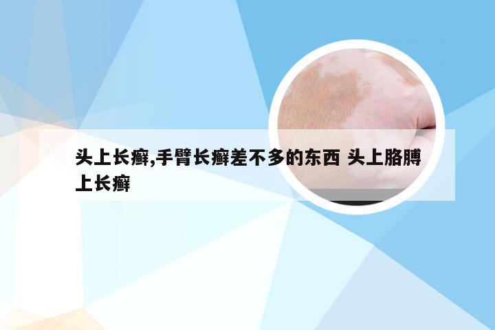 头上长癣,手臂长癣差不多的东西 头上胳膊上长癣
