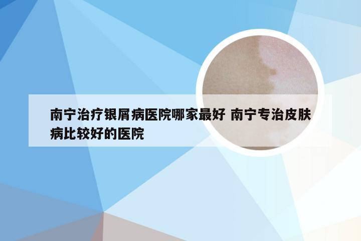 南宁治疗银屑病医院哪家最好 南宁专治皮肤病比较好的医院