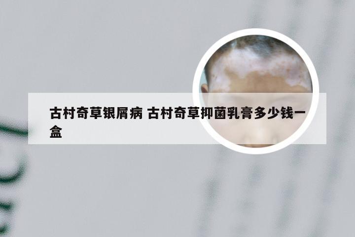 古村奇草银屑病 古村奇草抑菌乳膏多少钱一盒