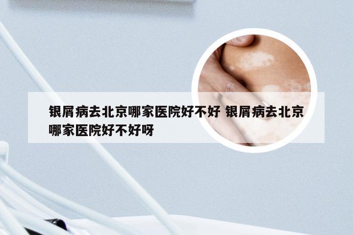 银屑病去北京哪家医院好不好 银屑病去北京哪家医院好不好呀