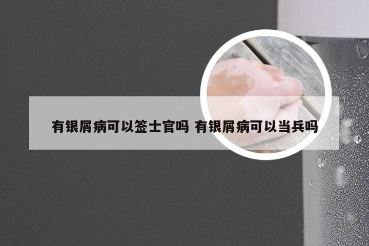 有银屑病可以签士官吗 有银屑病可以当兵吗